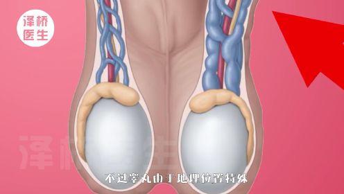“蛋蛋”的忧伤，男性不孕“元凶”——精索静脉曲张