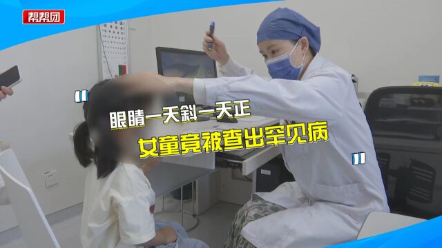 女童左眼一天斜一天正?竟患周期性内斜视 医生:多见于3~6岁