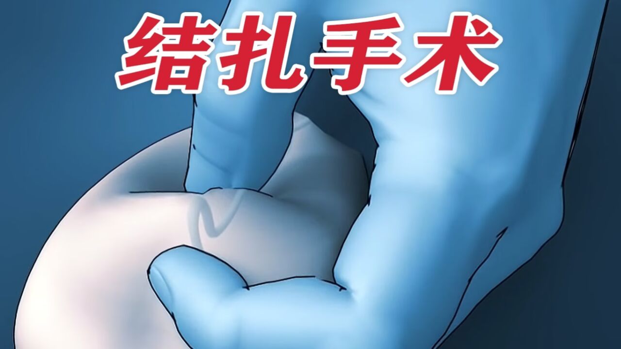 一分钟带你了解结扎手术_高清
