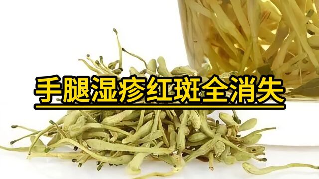 手腿湿疹红斑全消失,我的治愈之路!