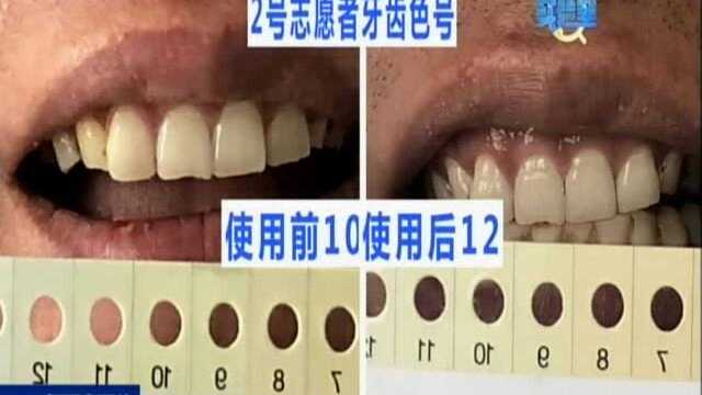 生活实验室:“网红”美白牙齿产品有用吗? 7天实测牙贴和牙粉 牙齿色号明显提升