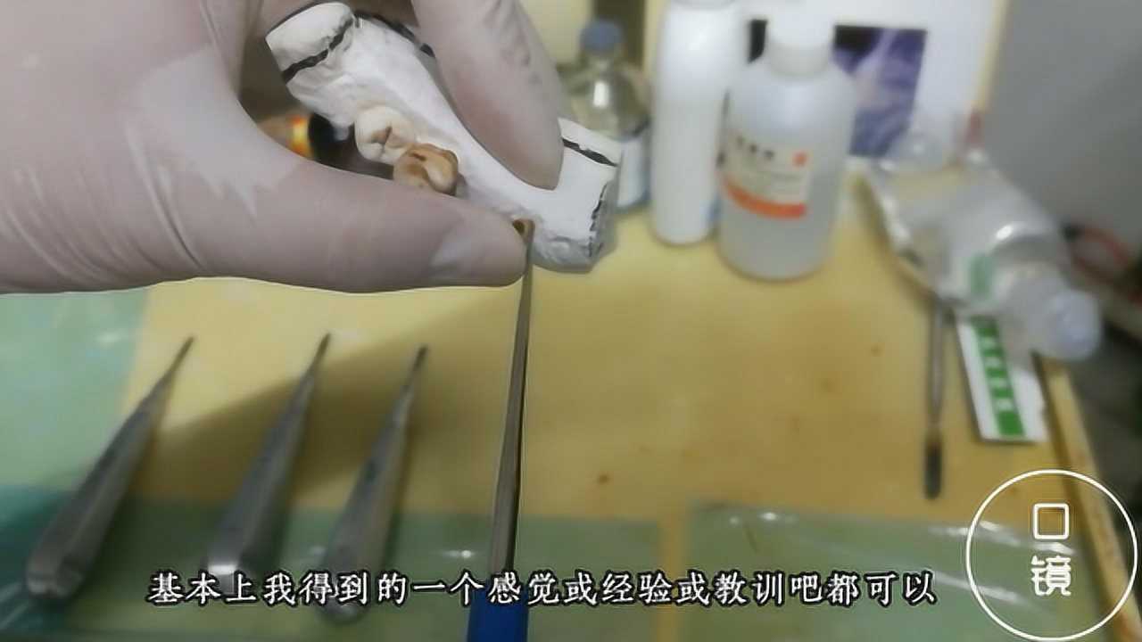 牙科拔牙挺子的正确使用方法_腾讯视频