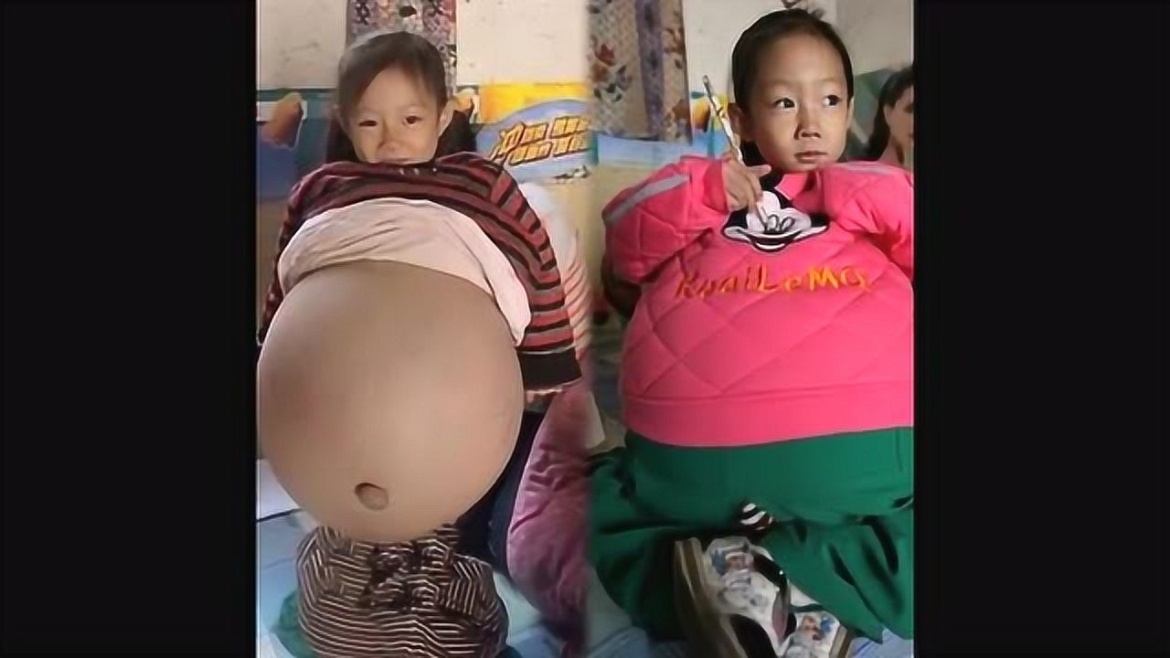 奇闻，10岁小女孩生下双胞胎_腾讯视频