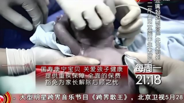 生命缘:玻璃人孕妇产出二斤八两女婴无呼吸无心跳,出生即被插管