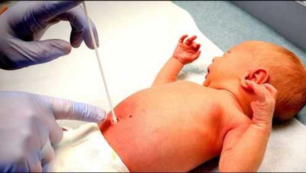 国外的新生儿体检全过程，快来看看和国内的有哪些不同_高清