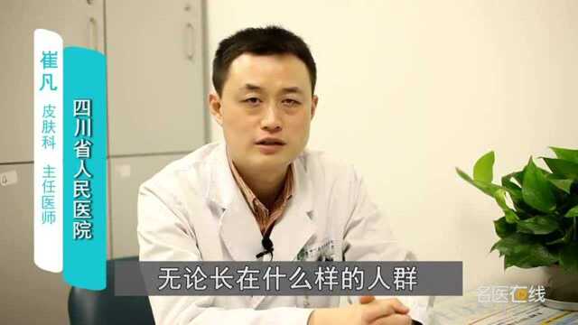 白癜风的症状有哪些