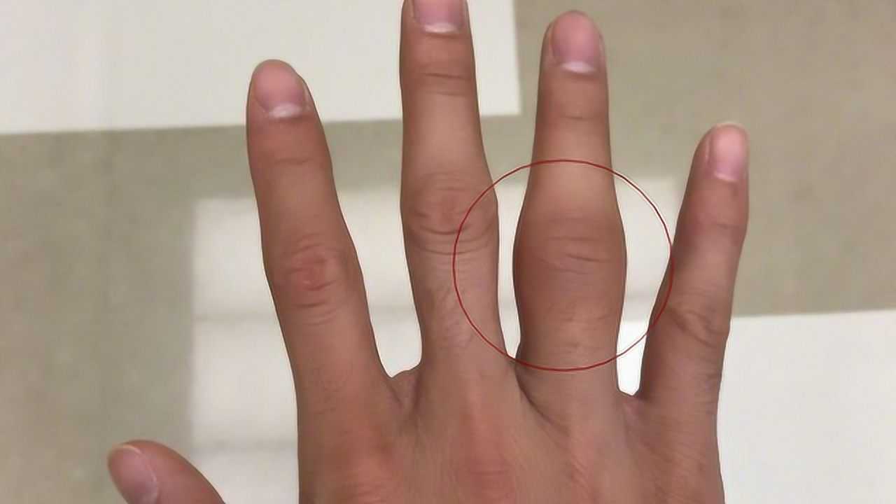 手上一旦出现这症状十有九患上脑梗现在知道还不晚