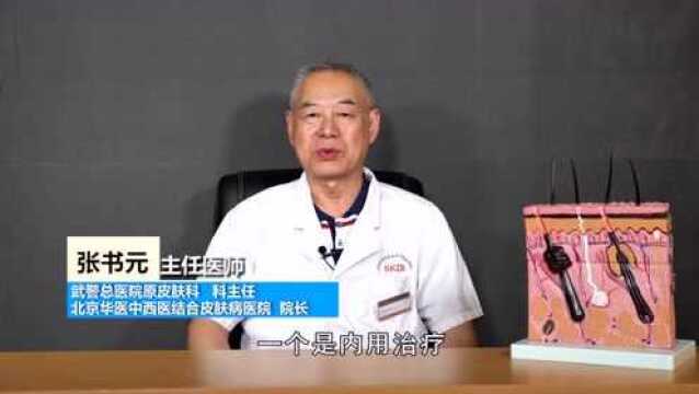 黑变病的治疗方法有哪些?主任医师张书元