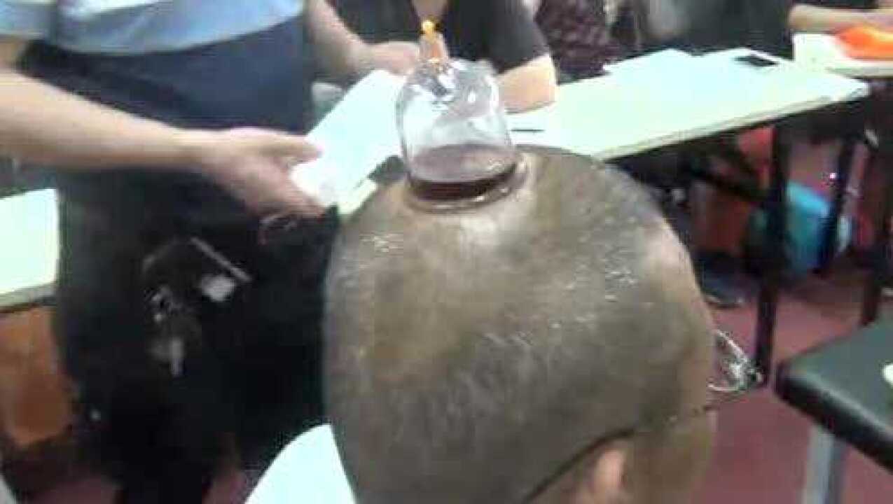 王合民~民间绝技刺络放血疗法(十七)_高清1080P在线观看平台_腾讯视频