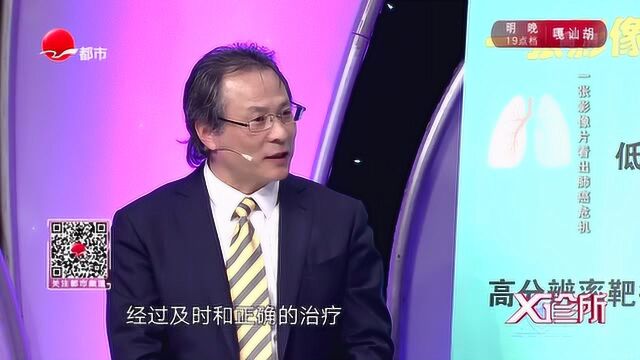 对抗肺癌的最好办法究竟是什么呢?这些建议你要注意了