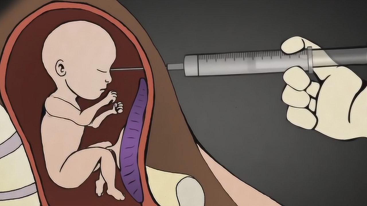 七个月引产的胎儿图片图片