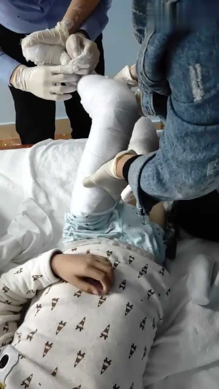 最享受打石膏的孩子