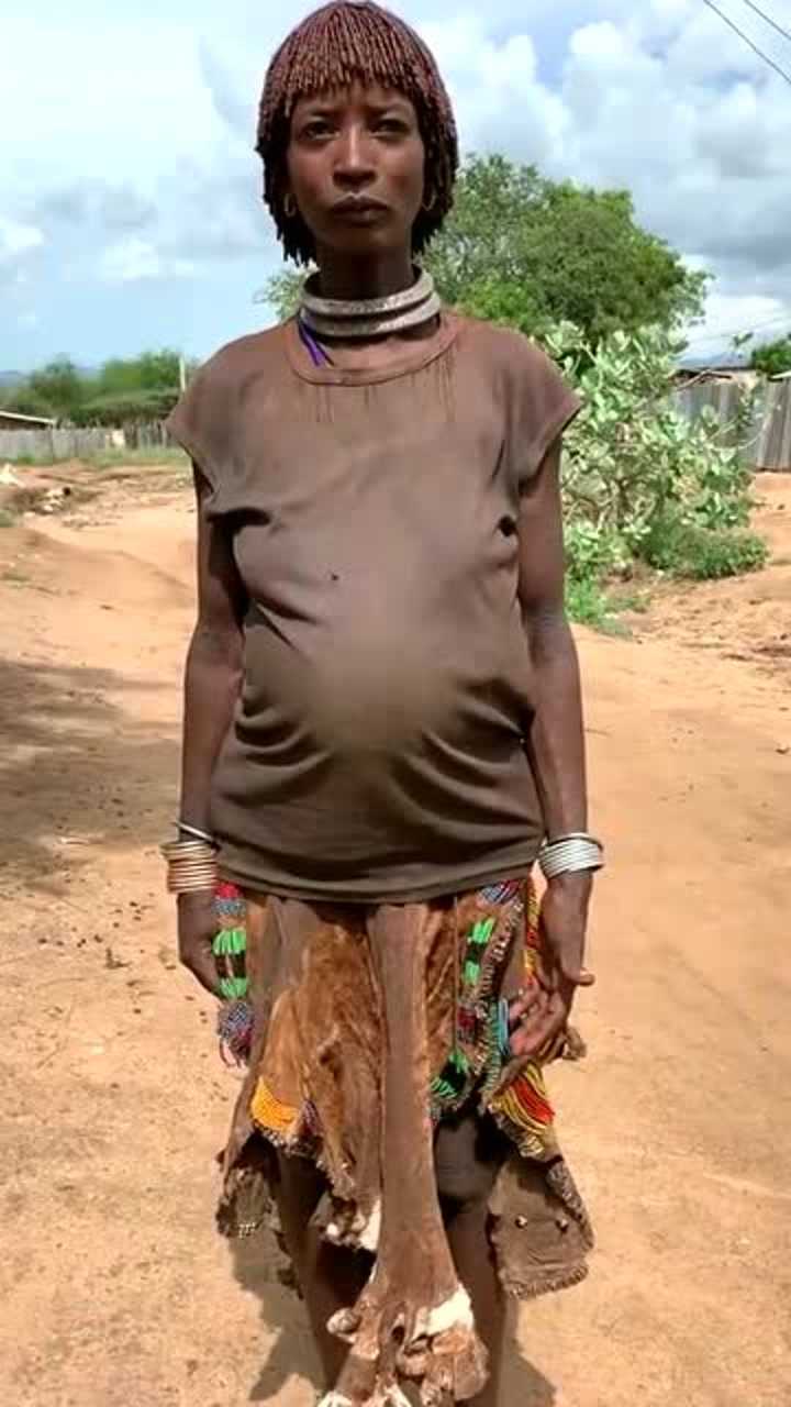 非洲最原始的部落孕妇居然就这种待遇真的是让人心疼