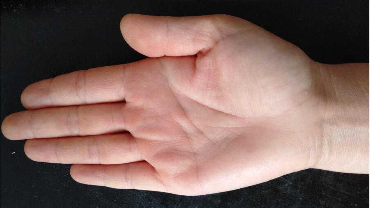 教你如何从手掌中看疾病, 看身体的健康状态, 准确率高达90%