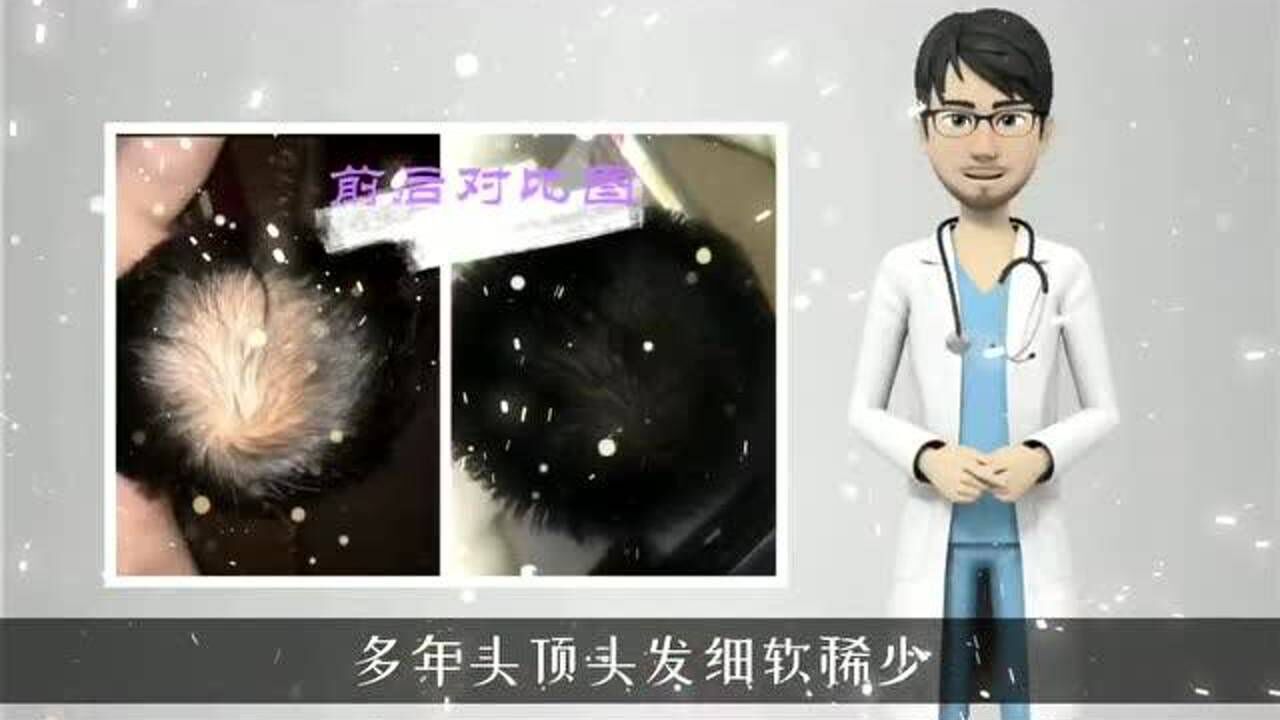 怎样生发效果最好?生发的最好的方法!_腾讯视频
