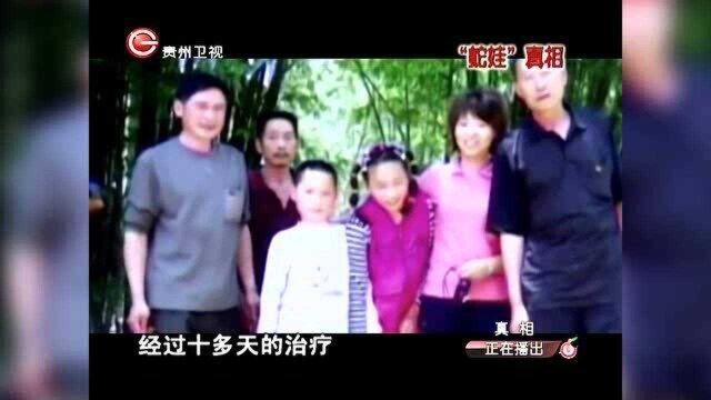 “蛇娃”一向狂躁不安,见生人便要撕咬,在医生治疗时竟异常温顺!