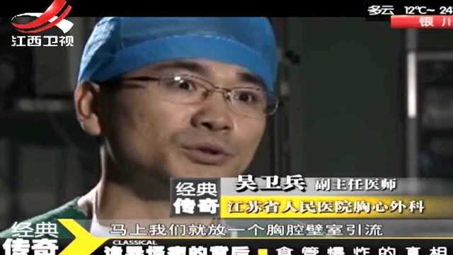 男子食管破裂,消化液进入胸腔,医生:不及时治疗必死无疑