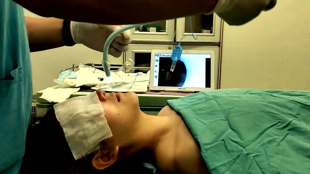 一次性可视管芯经鼻气管插管任意塑形轻松完成