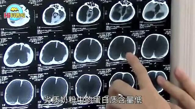 三聚氰胺事件13年,被三鹿奶粉毒害的30万孩子,现在怎么样了?