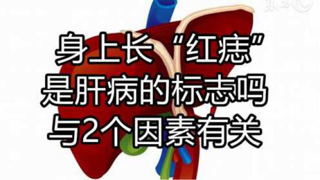 身上长“红痣”,是肝病的标志吗?医生:多半与这2个因素有关系