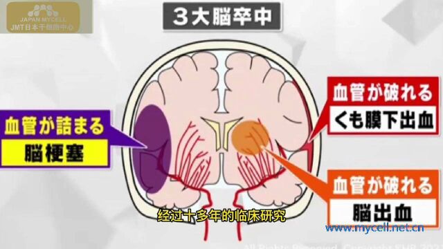 日本再生医疗MUSE干细胞的潜能