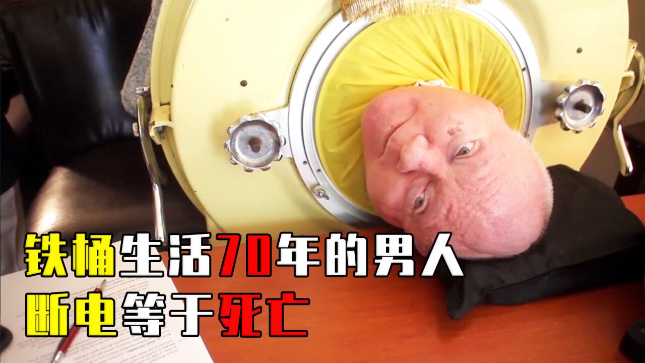 世界最后一个铁肺人:在铁桶生活70年,断电等于死亡?