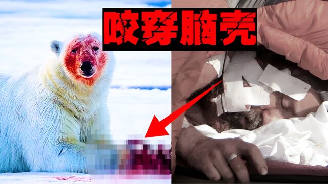 【北极熊吃人】被咬住听到骨裂的声音,把我当成另一种味道的肉!