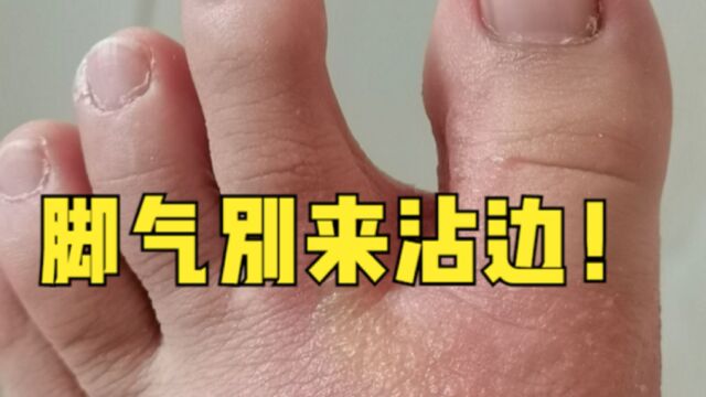 脚气如何根除?3个实用小方法,简单又有效,轻松根治不复发!