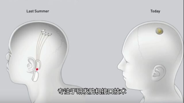 马斯克帝国旗下医疗产业  Neuralink 脑机接口