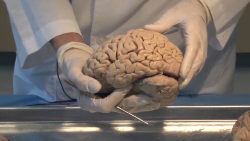大脑的构造，它为什么能诞生意识和思维？