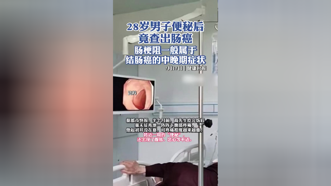 28岁男子便秘后竟查出肠癌,肠梗阻一般属于结肠癌的中晚期症状