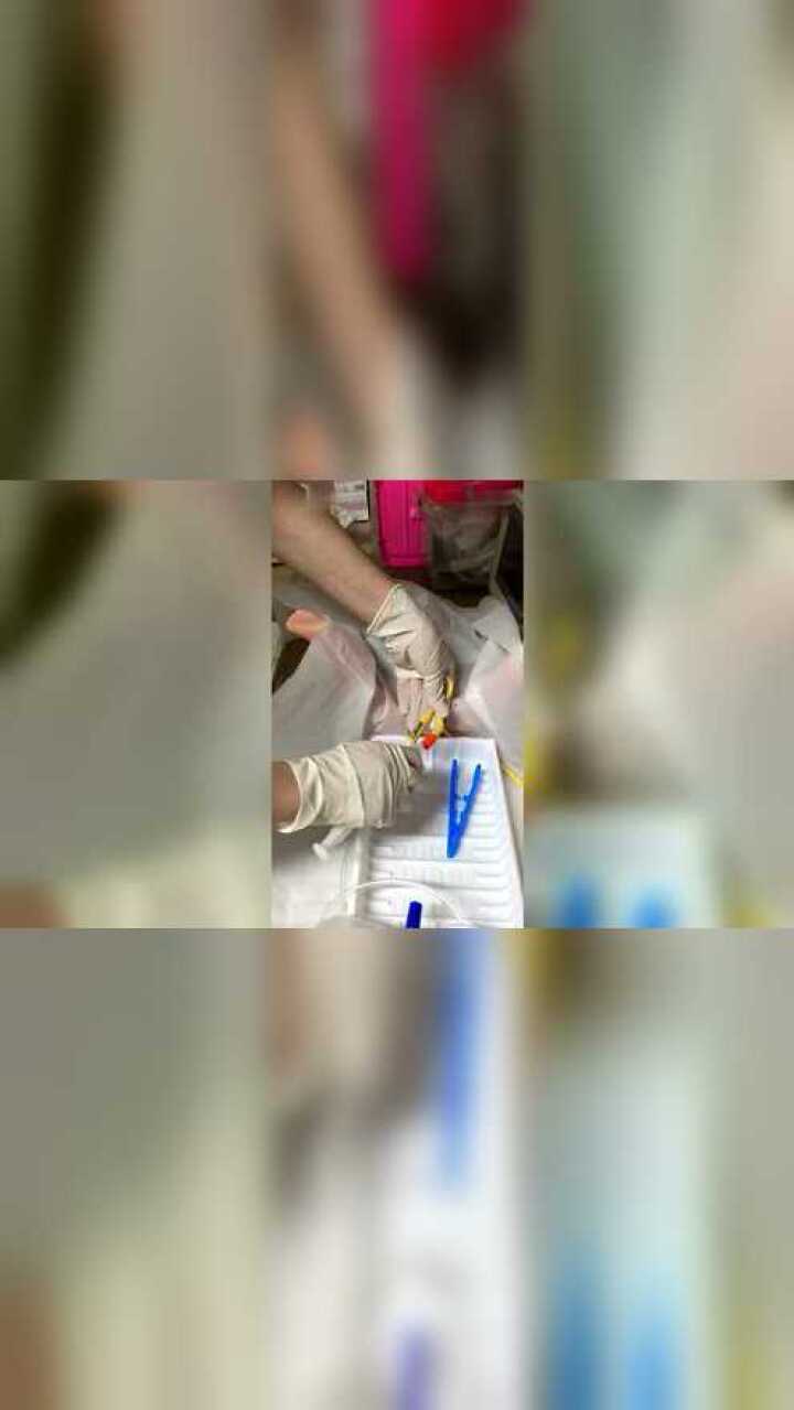 导尿操作新生婴儿护理_高清