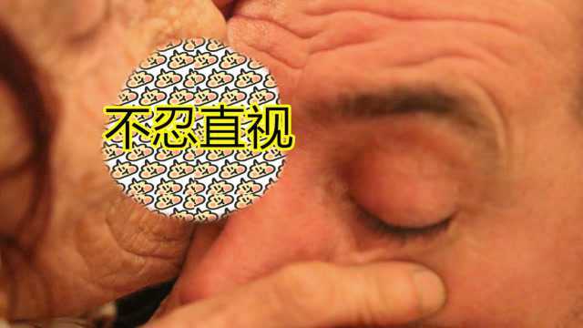 80岁老太太用舌头给人治眼病,直接伸进去,不怕添到眼屎?