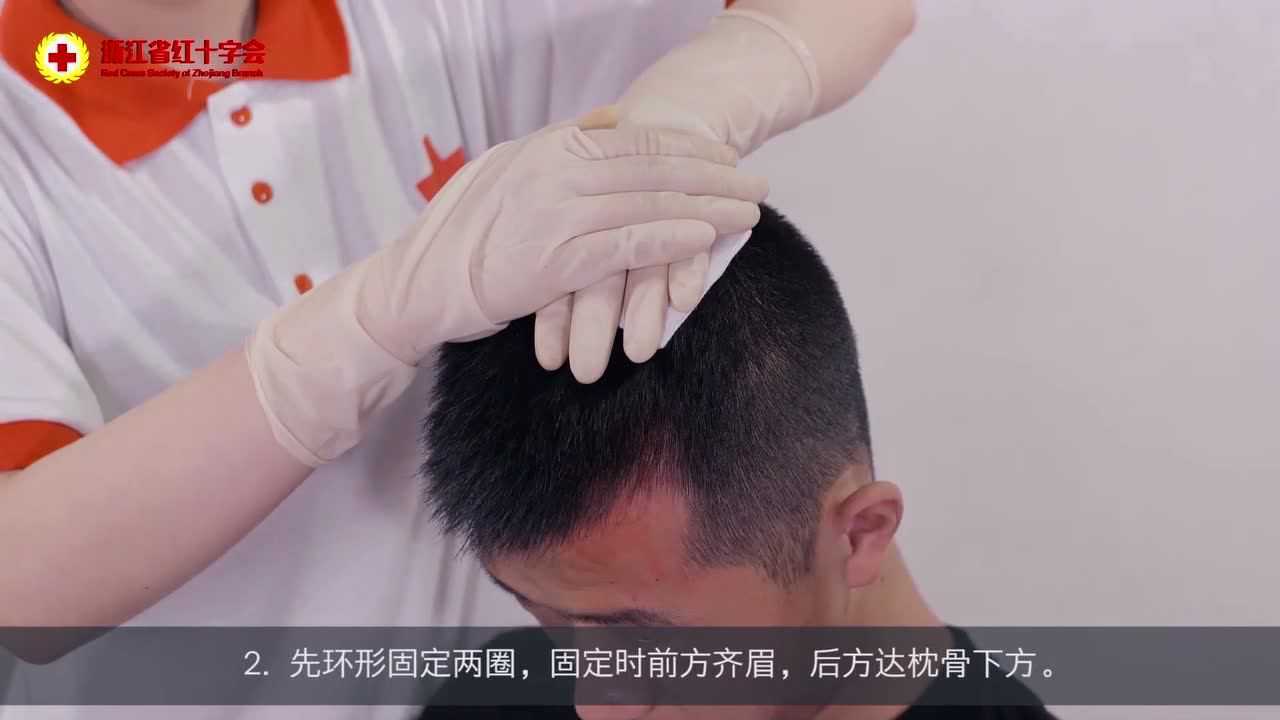 绷带回返包扎法——包头