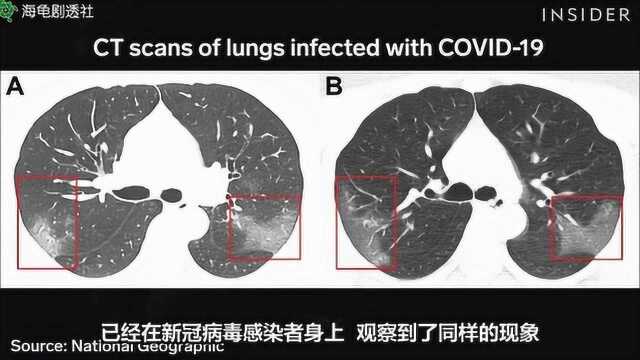 关于新冠肺炎,你应该知道这些事!