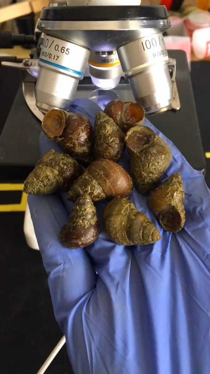 田螺到底有多少寄生虫在显微镜下就能看见
