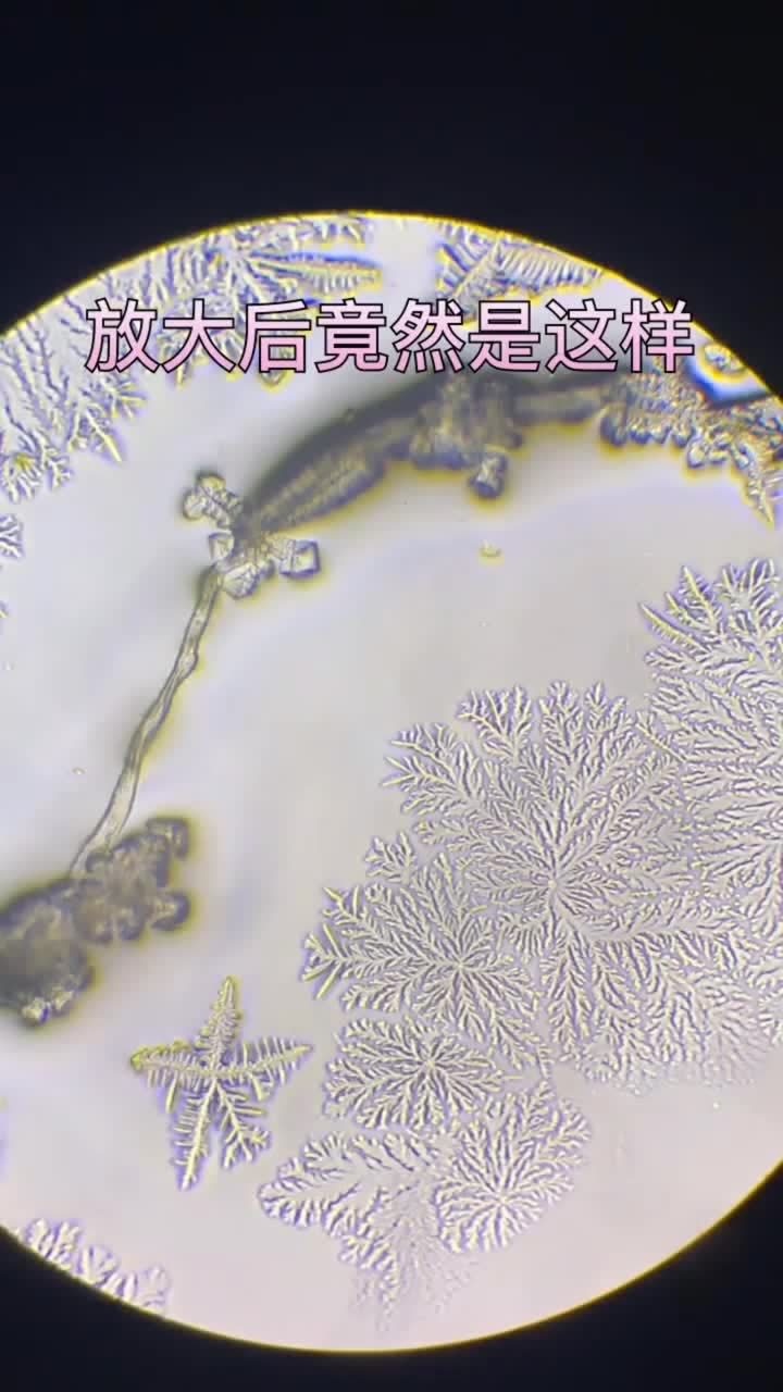 显微镜下观察眼泪这种晶体结构真是太美了你见过吗