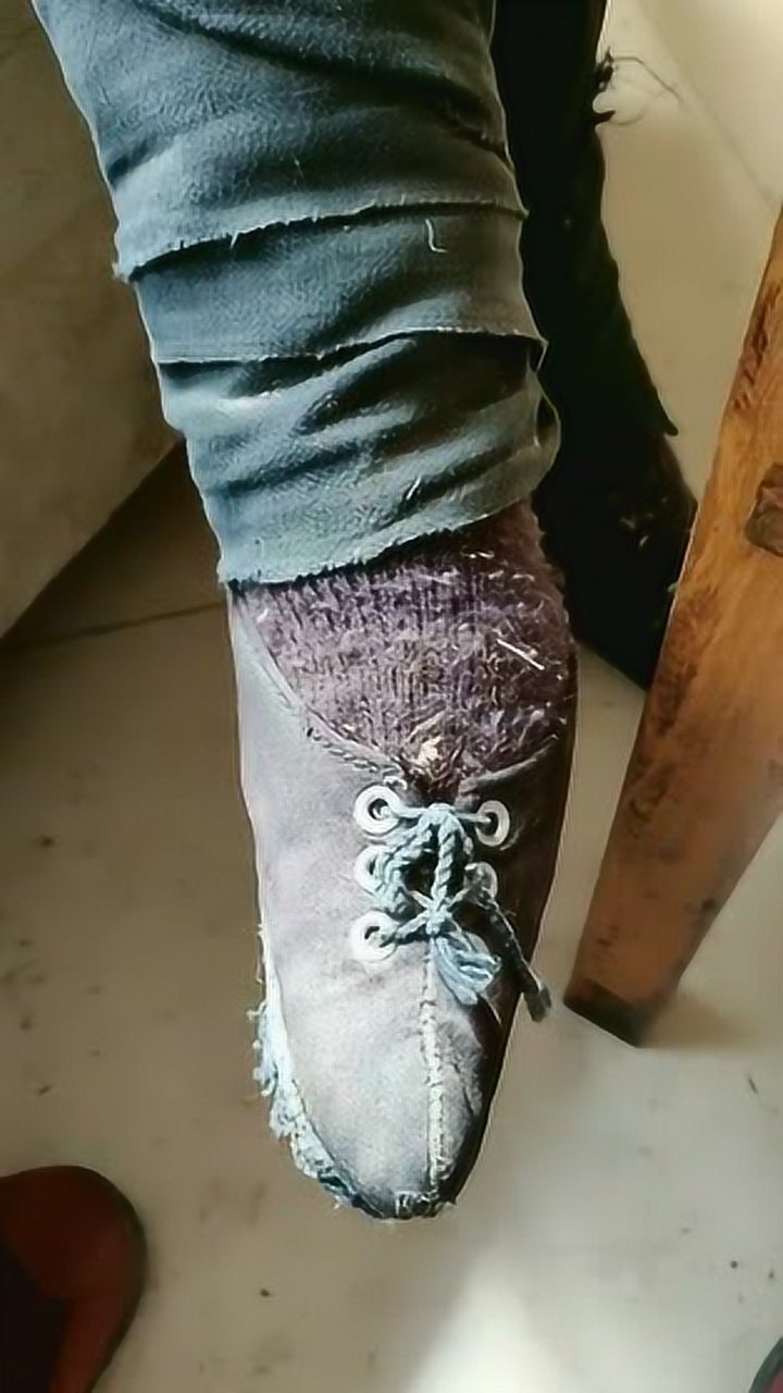 奶奶一百岁了三寸金莲的小脚就是觉着穿鞋子好费劲啊