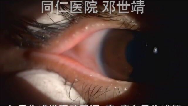 如果总是觉得眼睛干涩干痒,很可能是因为这个原因