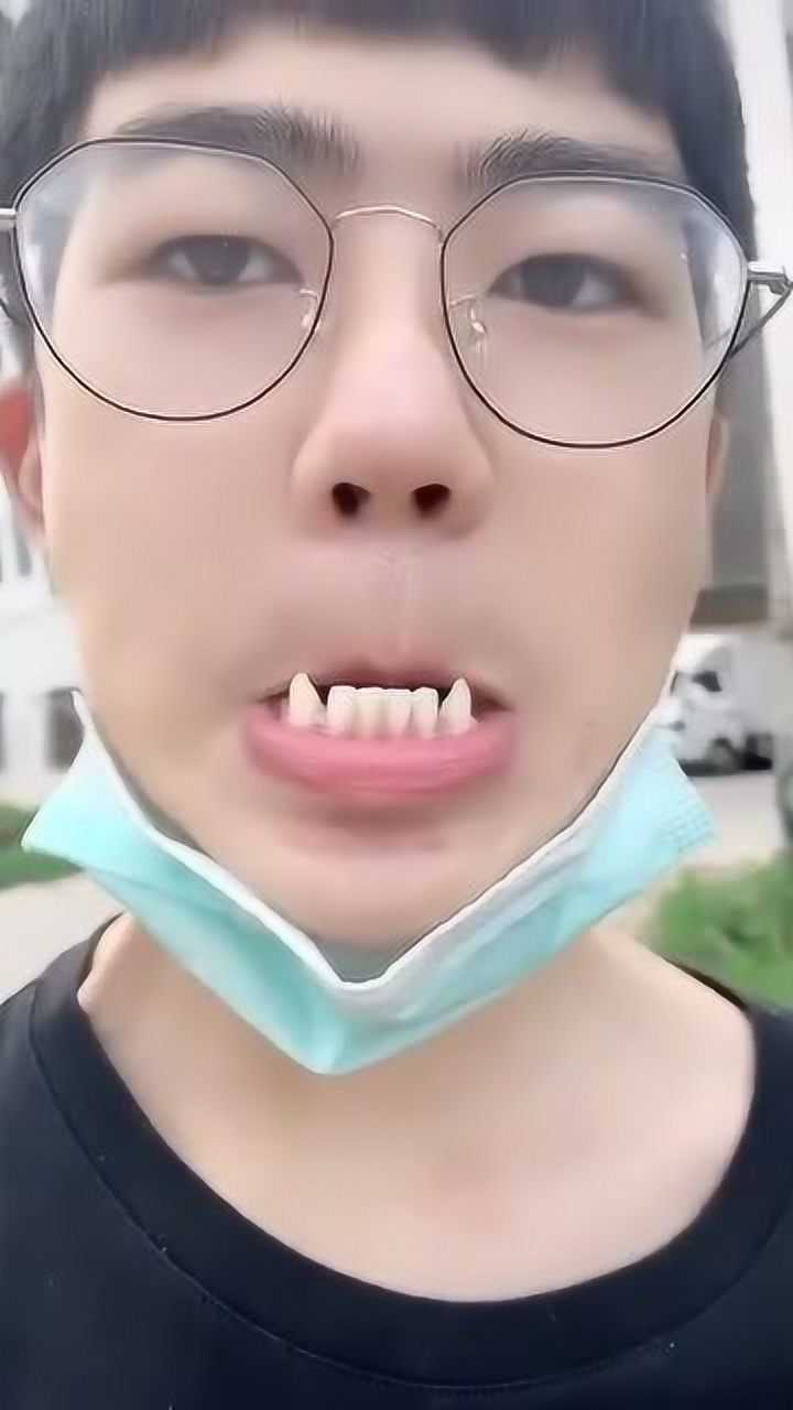 这牙是怎么长的和英叔僵尸电影里的僵尸牙有一拼了