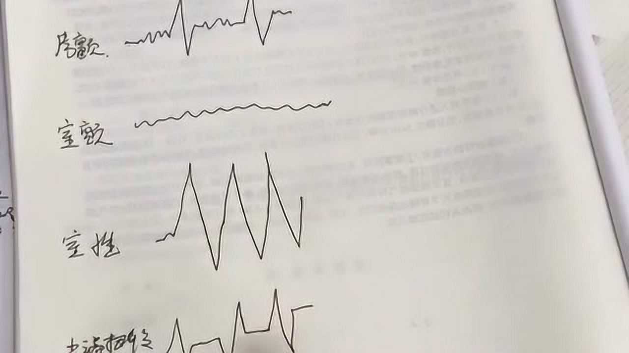 心电图医学生日常,不同的波浪线代表不同的含义!