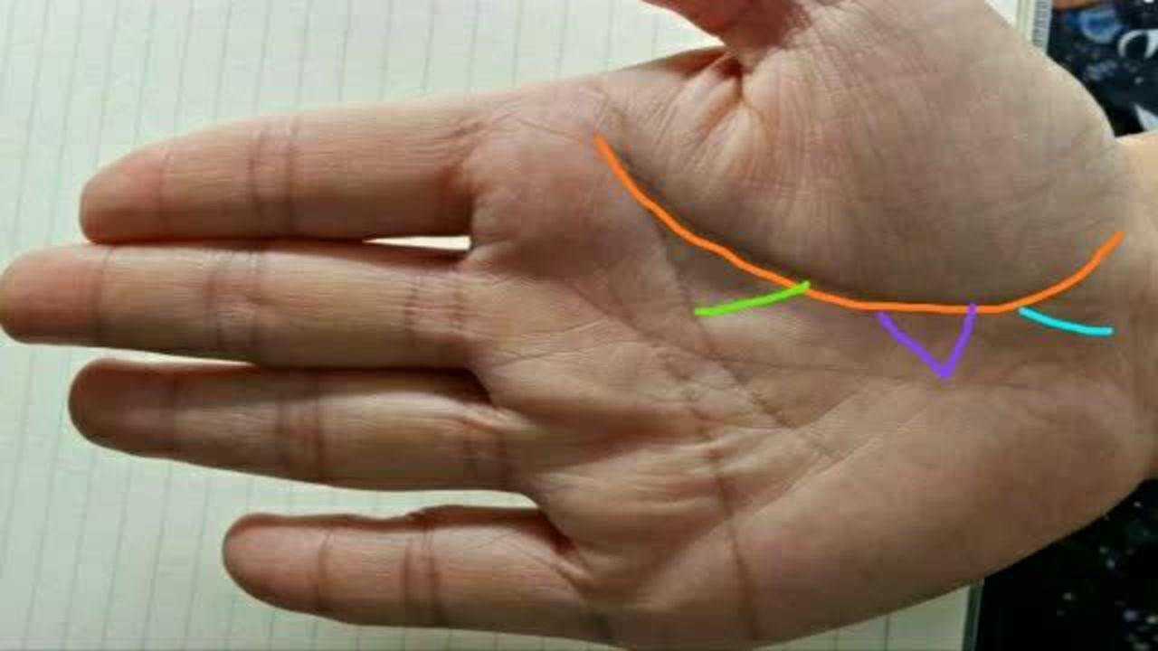 生命线出现分叉三角纹要注意了