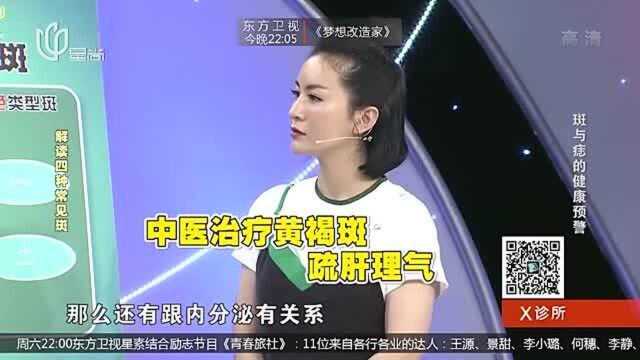 女性为啥会得黄褐斑?其中原理和治疗办法,赶紧了解下