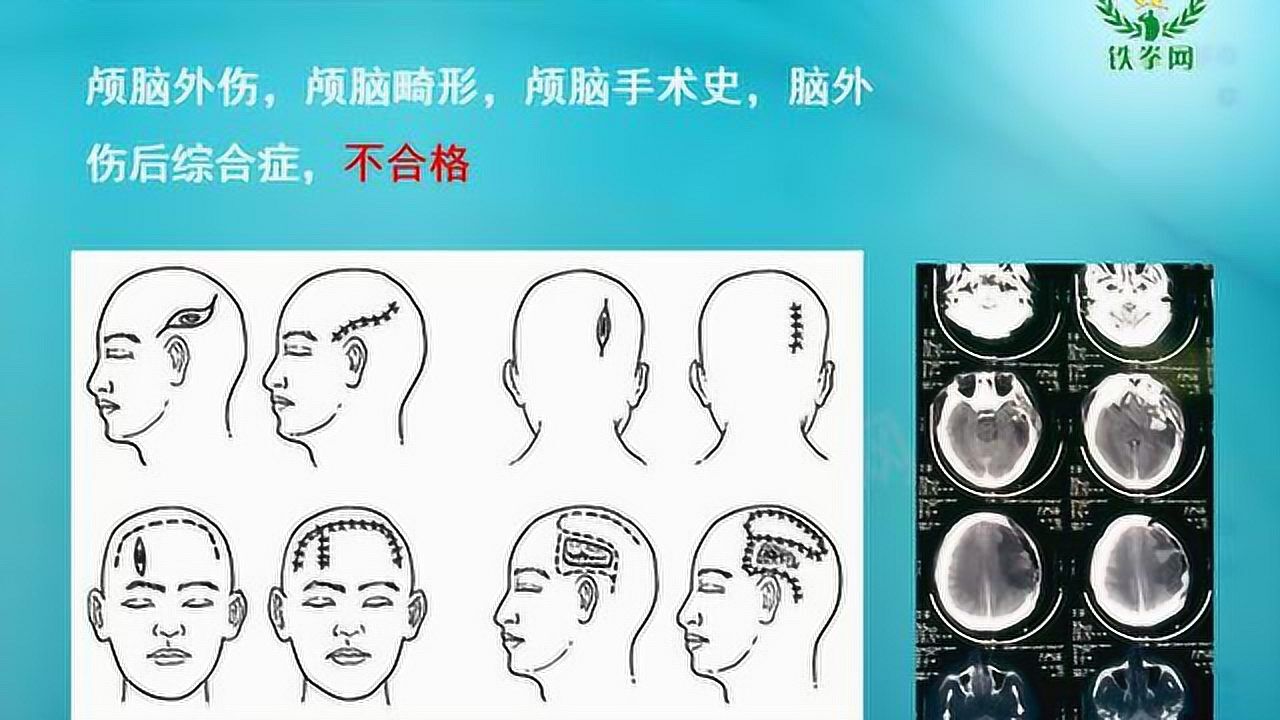 _高清1080P在线观看平台_腾讯视频