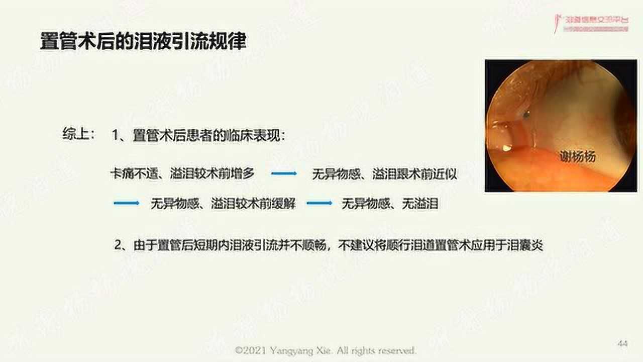 泪道置管应用解剖生理-泪道置管术后泪液引流规律-泪道插管-泪道成形_高清1080P在线观看平台_腾讯视频