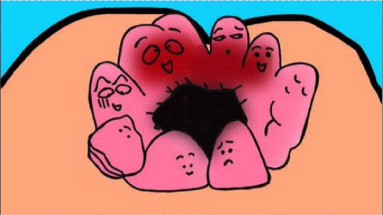 肛门长了个肉球很疼痔疮外痔肉球怎么消除怎么消除小偏方