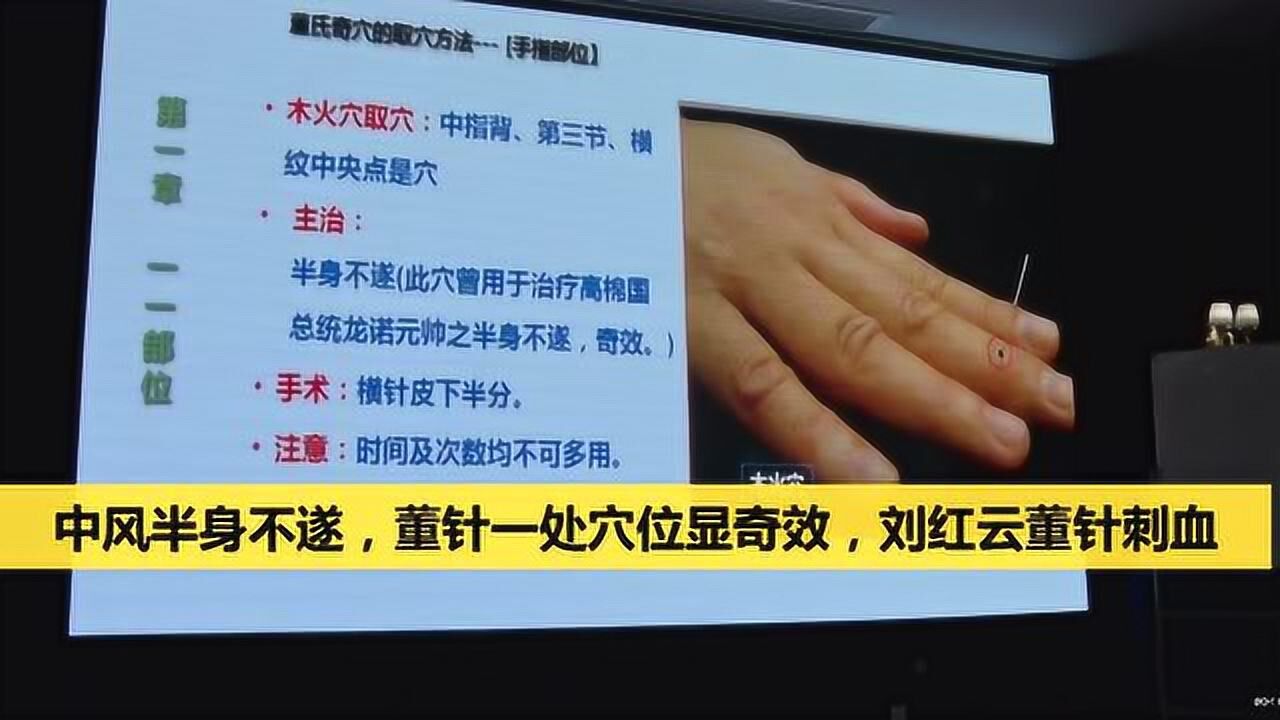 中风半身不遂,董针一处穴位显奇效,刘红云董针刺血