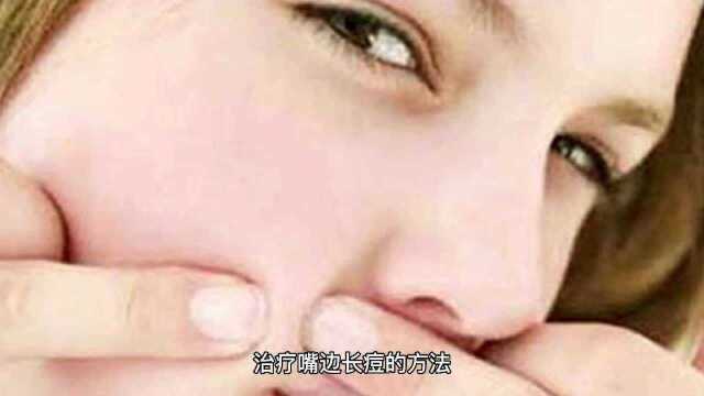 治疗嘴边长痘痘的方法