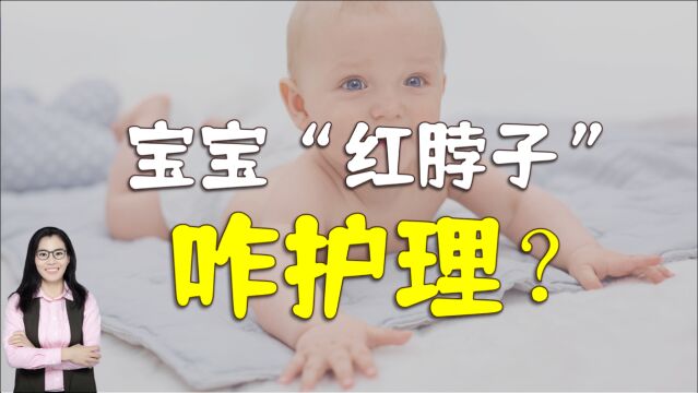 宝宝“红脖子”,用爽身粉就万事大吉了?正确处理方法家长要了解