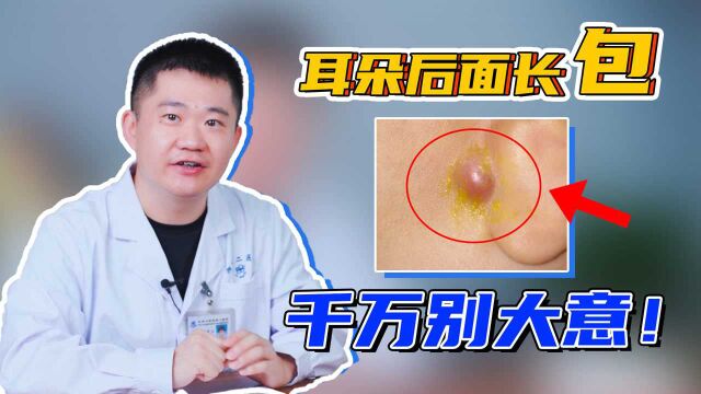 耳朵后面长硬包是怎么回事?医生:不是痘痘,可能是表皮样囊肿